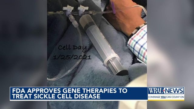 FDA approves gene therapies to treat Sickle Cell Disease