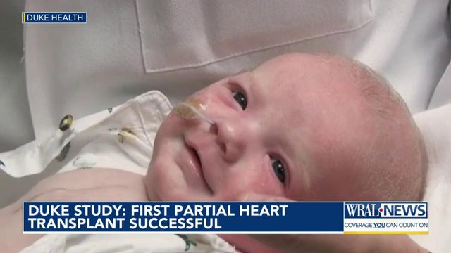 Duke: First partial heart transplant a success