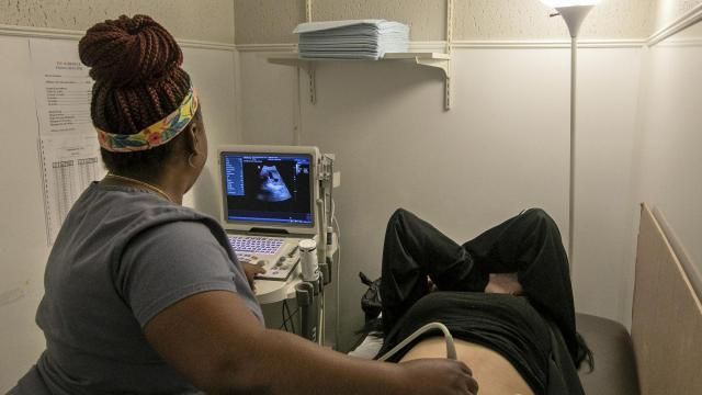 FILE - An operating room technician performs an ultrasound on a patient at Hope Medical Group for Women in Shreveport, La., on July 6, 2022. Doctors in states with strict abortion restrictions say an increasing number of pregnant women are seeking early prenatal testing, hoping to detect serious problems while they still have time to choose whether to continue the pregnancy. (AP Photo/Ted Jackson, File) FILE - An operating room technician performs an ultrasound on a patient at Hope Medical Group for Women in Shreveport, La., on July 6, 2022. Doctors in states with strict abortion restrictions say an increasing number of pregnant women are seeking early prenatal testing, hoping to detect serious problems while they still have time to choose whether to continue the pregnancy. (AP Photo/Ted Jackson, File)