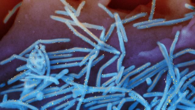FILE - This electron microscope image provided by the National Institutes of Health shows human respiratory syncytial virus (RSV) virions, colorized blue, and anti-RSV F protein/gold antibodies, colorized yellow, shedding from the surface of human lung cells. On Thursday, Feb. 29, 2024, health officials said they are investigating whether there's a link between two new RSV vaccines and cases of Guillain-Barre syndrome, a rare nervous system disorder, in older U.S. adults who got the shot. (National Institute of Allergy and Infectious Diseases, NIH via AP, File) FILE - This electron microscope image provided by the National Institutes of Health shows human respiratory syncytial virus (RSV) virions, colorized blue, and anti-RSV F protein/gold antibodies, colorized yellow, shedding from the surface of human lung cells. On Thursday, Feb. 29, 2024, health officials said they are investigating whether there's a link between two new RSV vaccines and cases of Guillain-Barre syndrome, a rare nervous system disorder, in older U.S. adults who got the shot. (National Institute of Allergy and Infectious Diseases, NIH via AP, File)