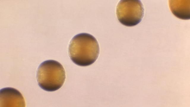 This 1966 microscope photo shows five colonies of Group-B Neisseria meningitidis bacteria. On Thursday, March 28, 2024, the CDC issued an alert to U.S. doctors about an increase in cases of one type of invasive meningococcal disease, mostly due to the serogroup Y strain of the bacteria. Four hundred and twenty two cases were reported in 2023, which was the most in a single year since 2014. There have been 143 reported this year so far. (Dr. Brodsky/CDC via AP) This 1966 microscope photo shows five colonies of Group-B Neisseria meningitidis bacteria. On Thursday, March 28, 2024, the CDC issued an alert to U.S. doctors about an increase in cases of one type of invasive meningococcal disease, mostly due to the serogroup Y strain of the bacteria. Four hundred and twenty two cases were reported in 2023, which was the most in a single year since 2014. There have been 143 reported this year so far. (Dr. Brodsky/CDC via AP)