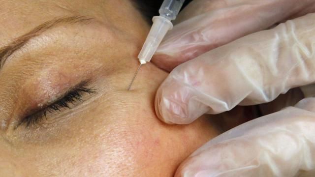 A patient receives a Botox injection at a clinic in Arlington, Va., on June 5, 2009. On Tuesday, April 23, 2024, the Centers for Disease Control and Prevention issued a warning about counterfeit Botox injections after more than 20 people got sick. All of the people told health officials that they got the shots from unlicensed individuals or in settings like homes or spas. (AP Photo/Jacquelyn Martin, File) A patient receives a Botox injection at a clinic in Arlington, Va., on June 5, 2009. On Tuesday, April 23, 2024, the Centers for Disease Control and Prevention issued a warning about counterfeit Botox injections after more than 20 people got sick. All of the people told health officials that they got the shots from unlicensed individuals or in settings like homes or spas. (AP Photo/Jacquelyn Martin, File)