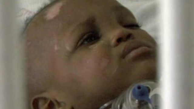 18-month-old girl recovering after being hit by car