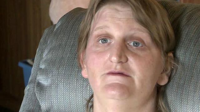 Henderson mother badly burned in June fire out of hospital