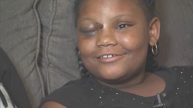 9-year-old shot in face recovering at home