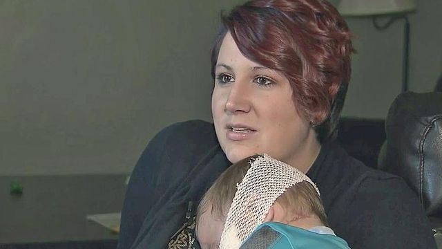 Toddler recovering at home after dog attack