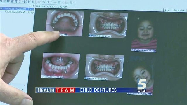 Genetic condition can lead to child dentures