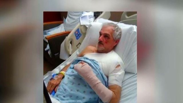 Moped hit-and-run victim has long road to recovery