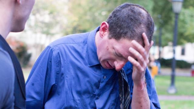 Teacher burned by Davie Poplar tree fire