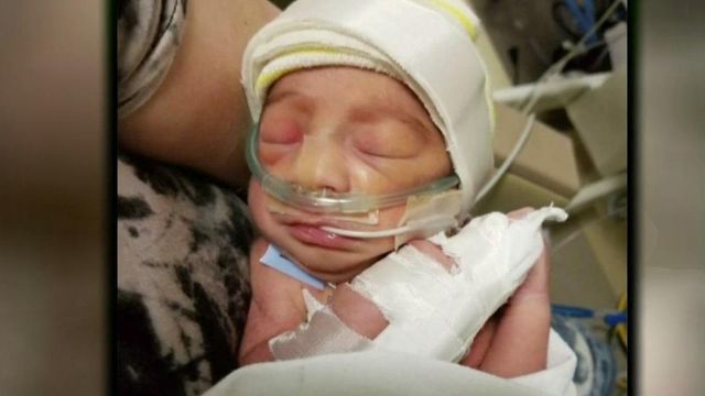 Baby born early after mom struck by car