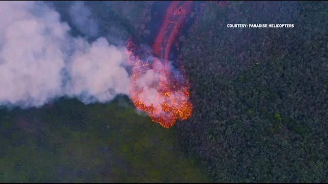 First major injury caused by Hawaii volcano