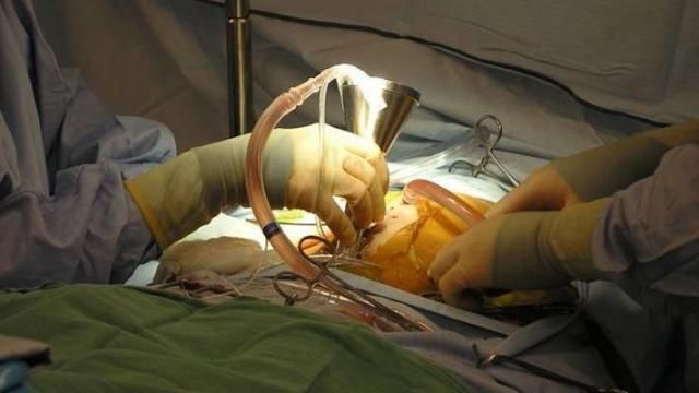 Surgery