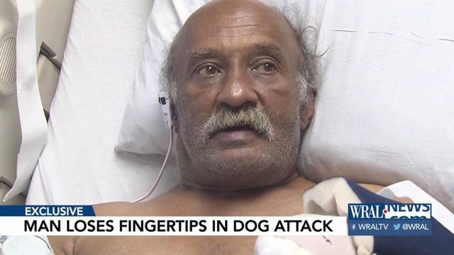 Fayetteville man's fingers bitten off during dog attack