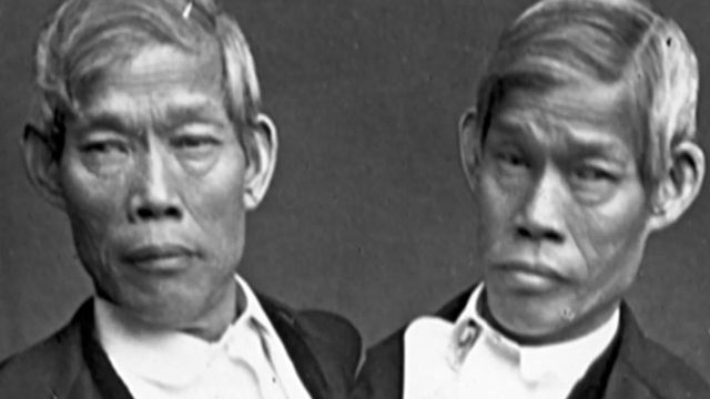 Siamese twins who settled in Surry County have long lineage