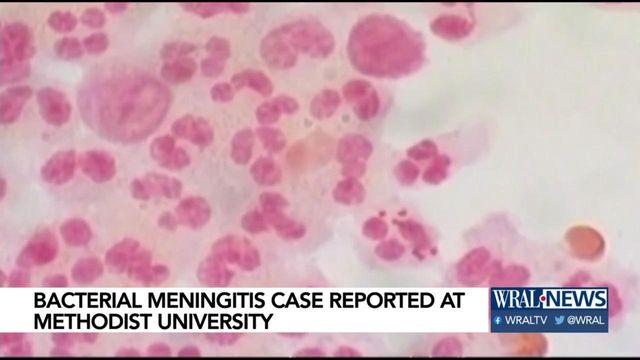 Bacterial meningitis scare at Methodist University 