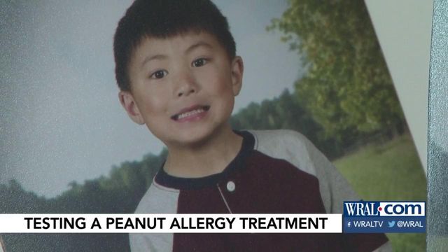 UNC doc's work on peanut allergy treatment hits close to the heart