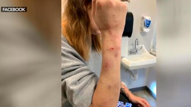 Woman saves child during dog attack