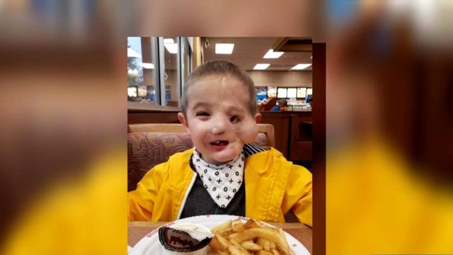 Raleigh boy making progress four years after attacked by dogs