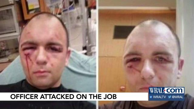 Maxton police officer attacked during service call