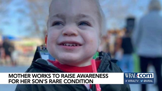 Raleigh mother working to raise awareness of son's rare condition