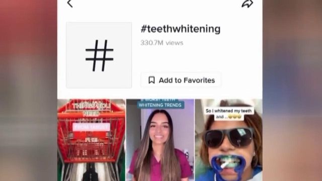 Dentist warns of potential problems with do-it-yourself teeth whitening videos
