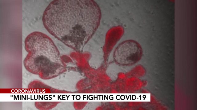 Duke: 'Mini-lungs' key to fighting COVID-19