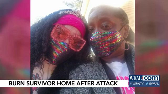 Burn victim returns home after long stint in hospital