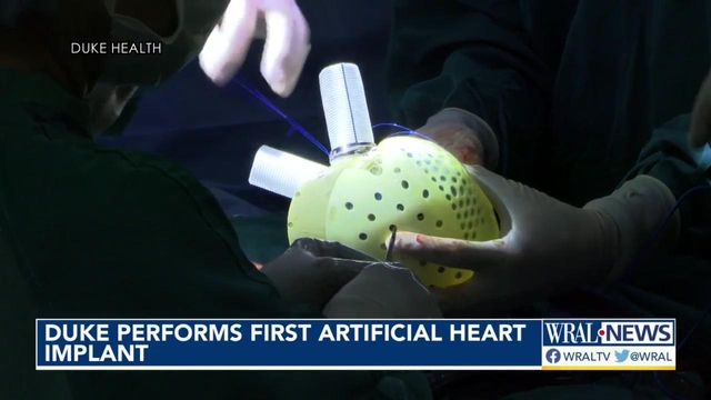 NC father makes history as first person with artificial heart implant