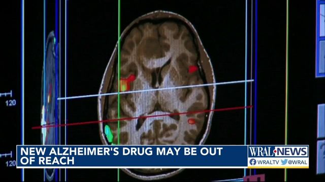 Hopes dashed as new Alzheimer's drug could become inaccessible for many