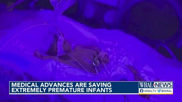 Medical advances saving extremely premature infants