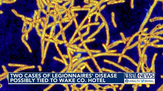 2 cases of Legionnaires' disease possibly tied to Wake County hotel 