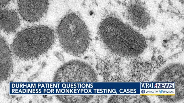 Durham patient questions state's readiness for monkeypox testing