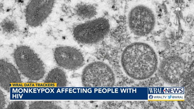 Growing number of people with HIV contracting monkeypox