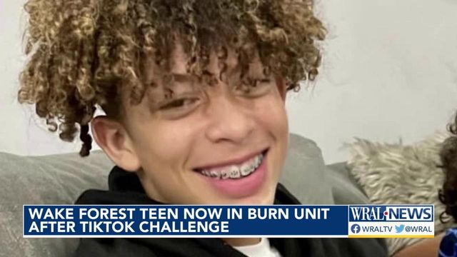 Boy, 16, Badly Burned Doing Social Media Challenge, Mom Says