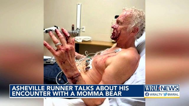 NC runner gains 'wilderness street cred' after being attacked by bear