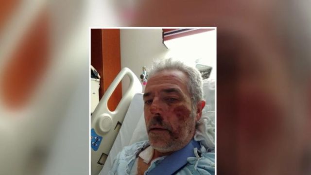 Biker with long road to recovery following hit-and-run crash