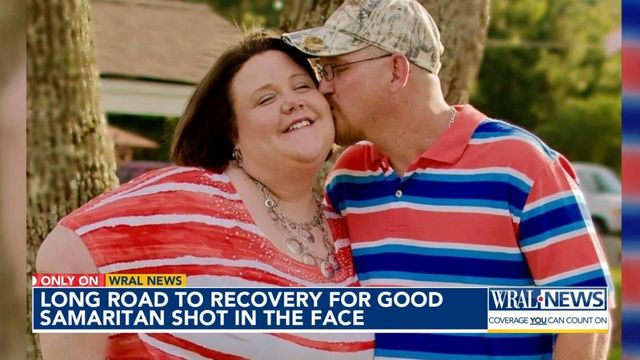 Long road to recovery for good Samaritan shot in the face  