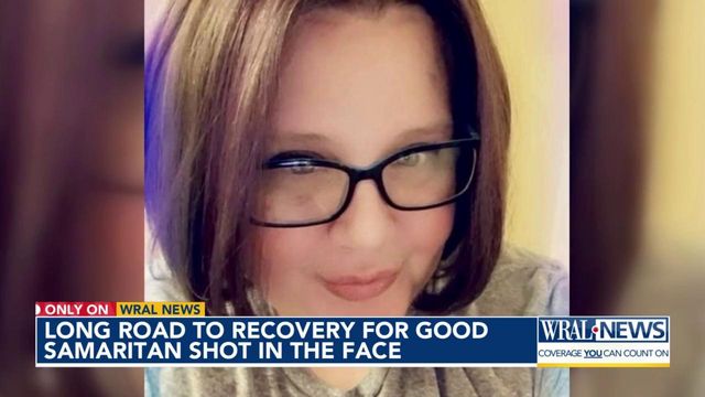 Long road to recovery for Good Samaritan shot in the face