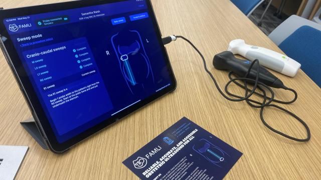 UNC doctor uses AI to help expecting mothers monitor their babies
