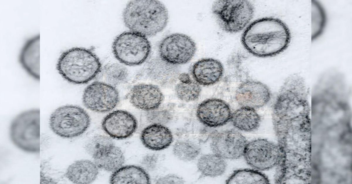 Hantavirus and COVID: Similar fears, major differences