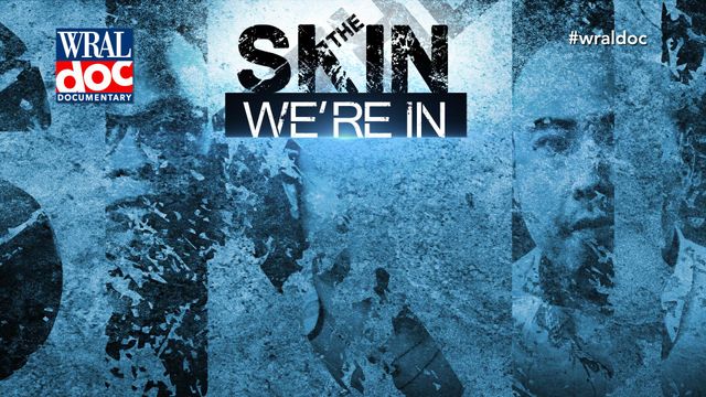 WRAL Documentary: The Skin We're In