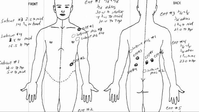 Griggs autopsy