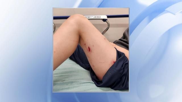 Dog attack at Wake Co. animal center