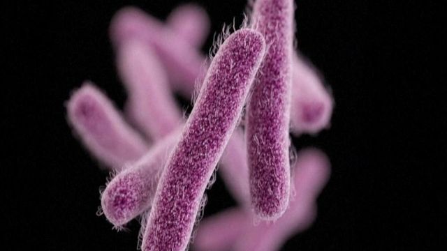 'Shigella' bacteria group may give you an upset stomach