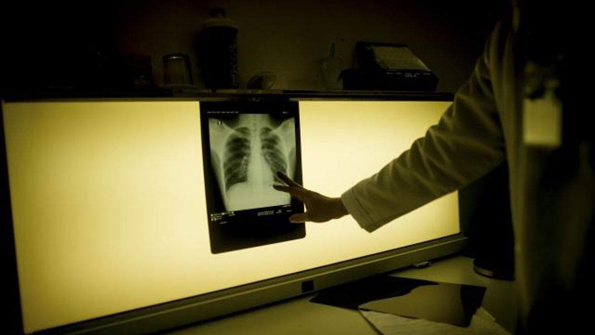 Fast, Cheap Testing for Tuberculosis? Soon It May Be Possible