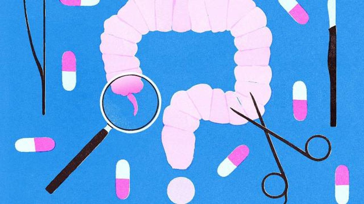 RESTRICTED -- The Case Against Appendectomies