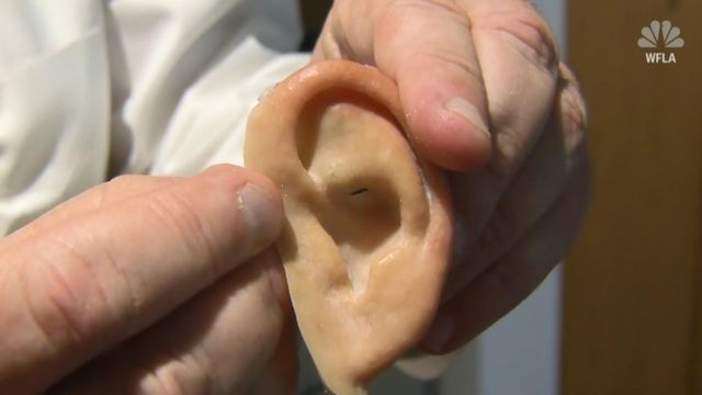 Prosthetic ear found on Florida beach
