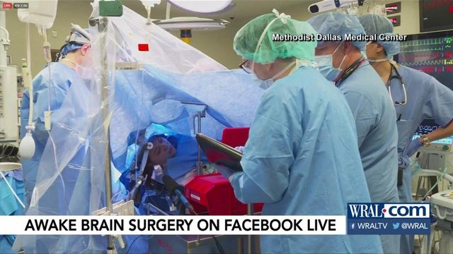 Patient has brain surgery while awake, broadcasting on Facebook Live
