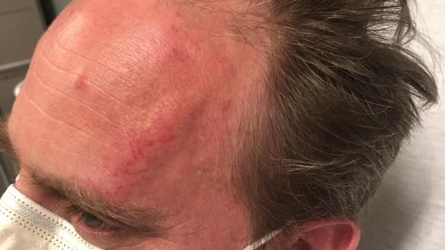 Reporter Paul Woolverton with the Fayetteville Observer was attacked while covering a looting at Cross Creek Mall on Saturday night.