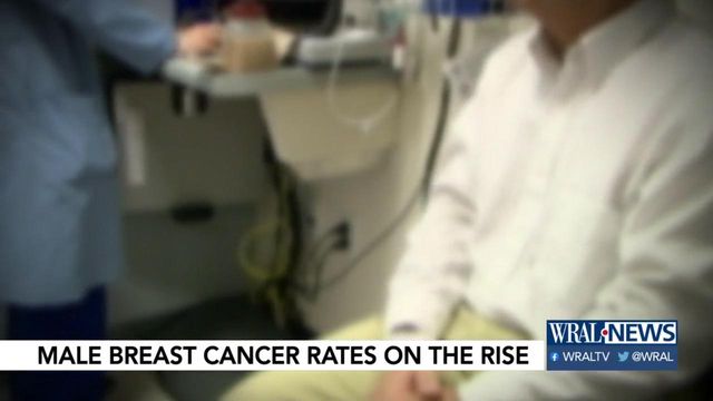 Male breast cancer rates on the rise 